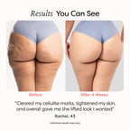 Anti-Cellulite Massage Oil